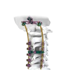 Sistemas de Columna