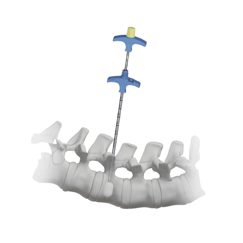 Cifoplastia y Vertebroplastia